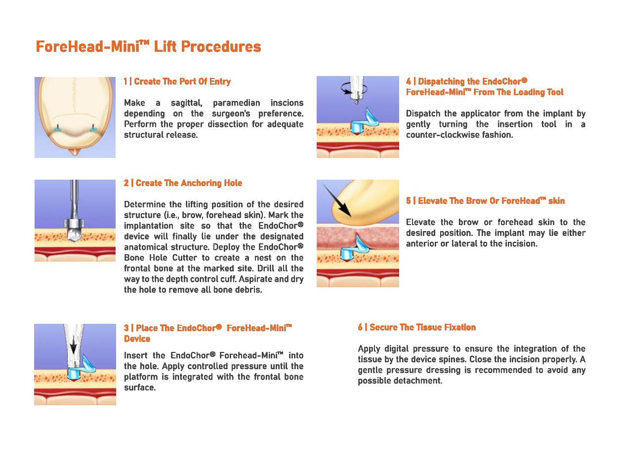 ForeHead-Mini™ — Application guide 2