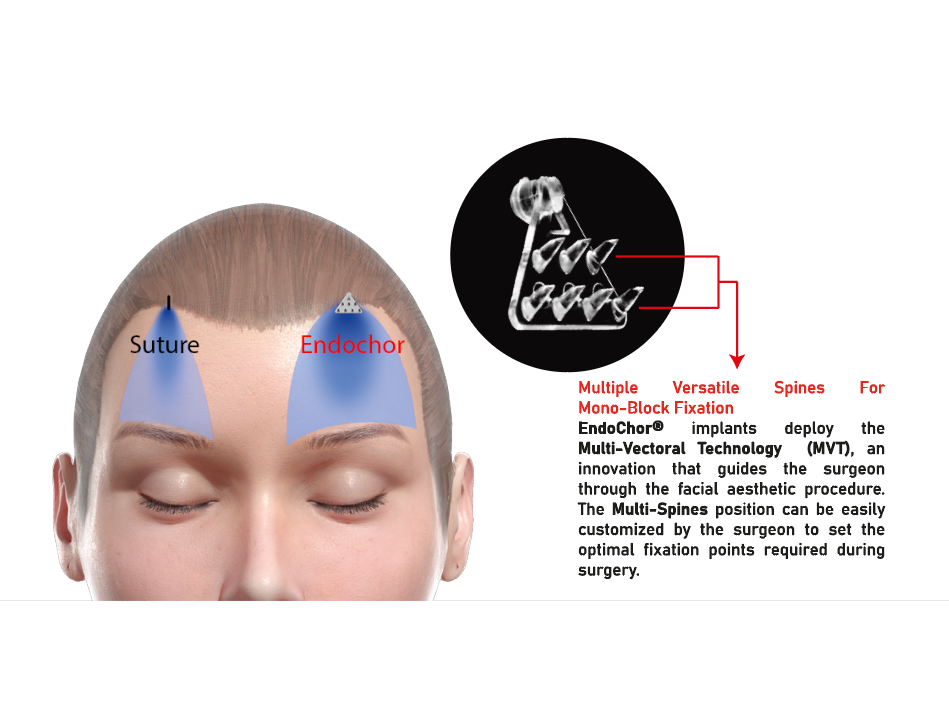 ForeHead™ — Application guide 1