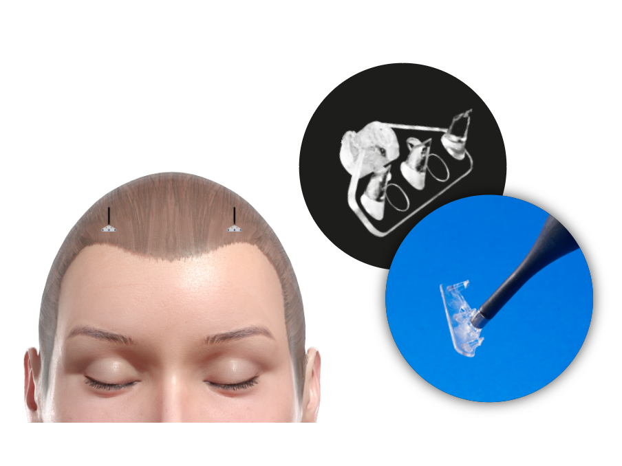 ForeHead-Mini™ — Application guide 1