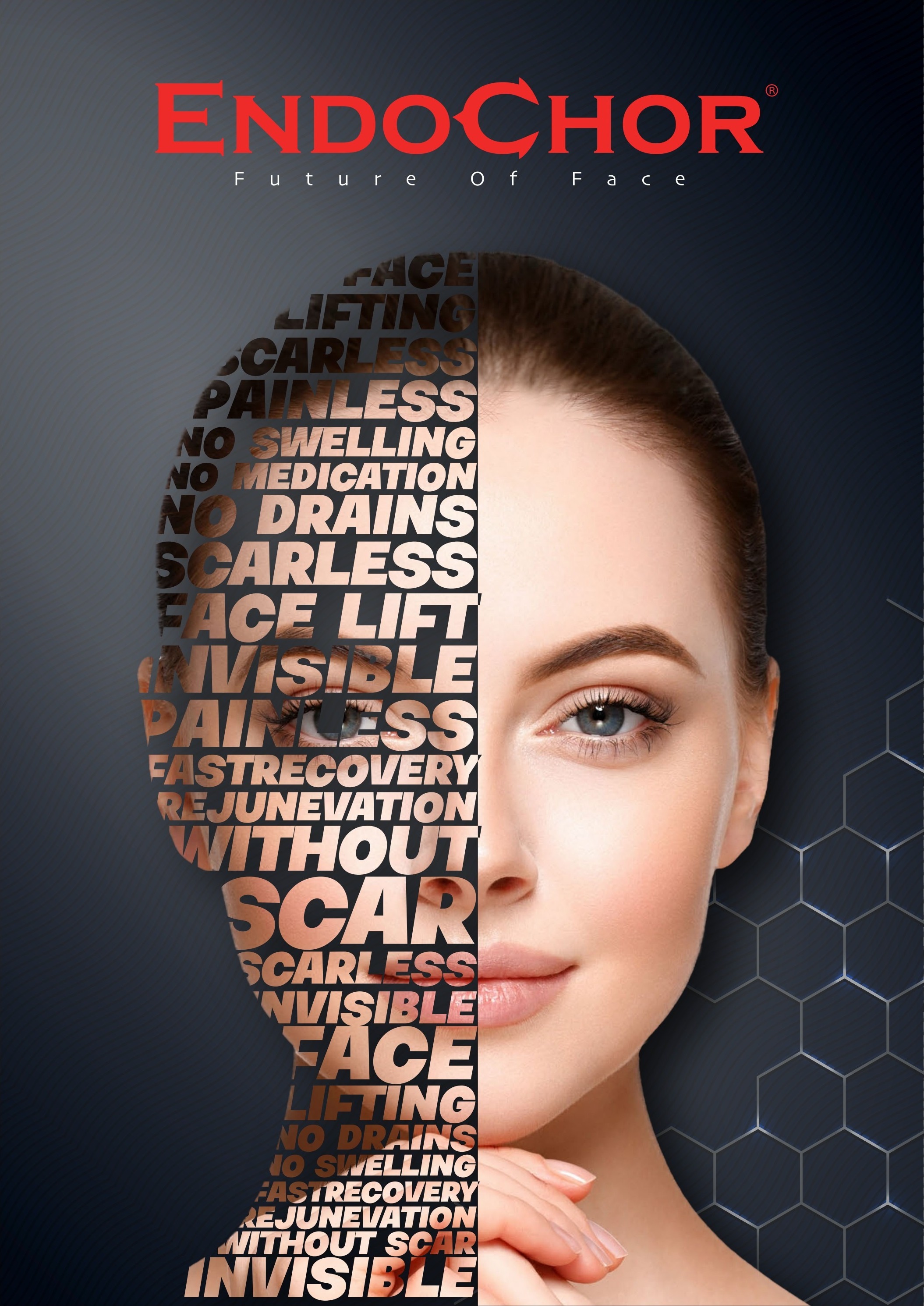 EndoChor facial fixation zones